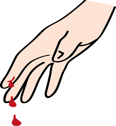 Ein blutender Finger